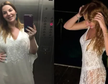 Luiza Zveiter recorda sequelas após bariátrica