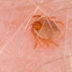 Febre maculosa mata 17 pessoas em São Paulo em 2026