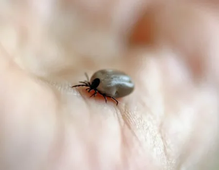 Mulher morre de febre maculosa no ABC; carrapatos foram encontrados em cães da vítima